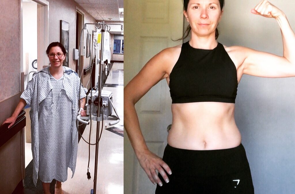 Strength Training changed how my body recovered from Endo surgery six.
